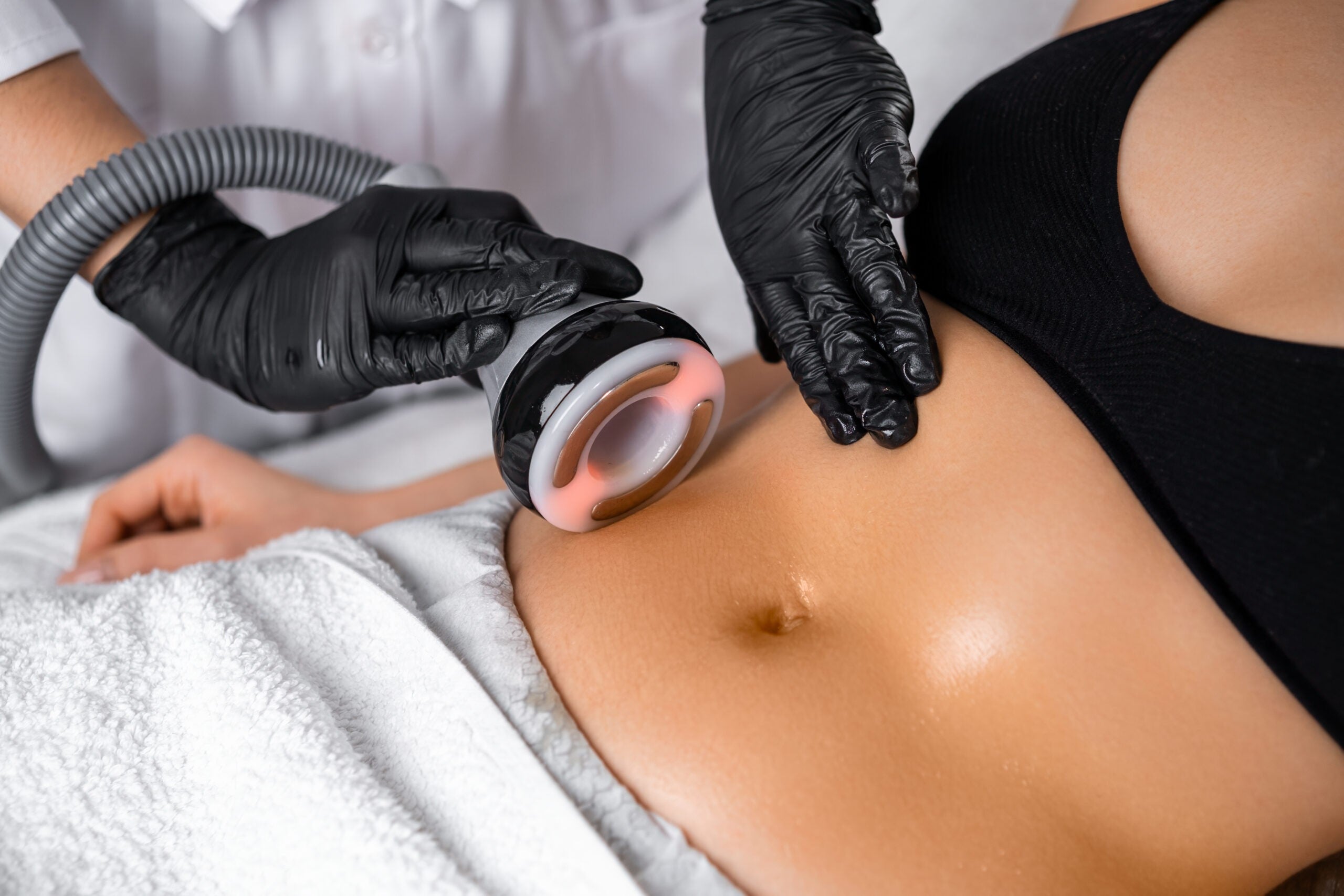 Laser Lipo Cavitation