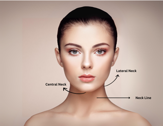 Lower Face Lift